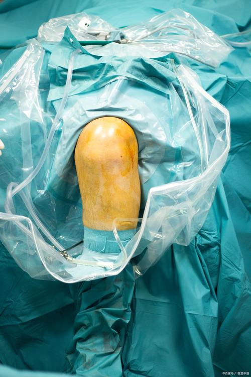 接受膝盖手术!专家谈加维:手术能更好保护膝关节但需长时间恢复