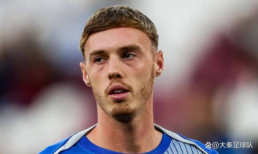 TA:帕尔默因腹股沟伤势将缺阵至11月,将缺席至少4场比赛